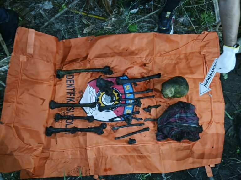 Polres Aceh Timur Evakuasi Temuan Kerangka Manusia di Kebun Kelapa